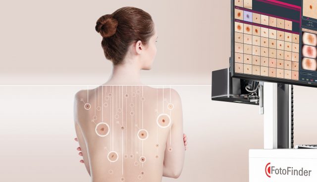 Canon Dermatologie